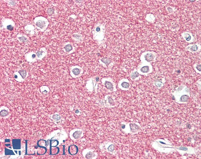 Anti-STX1A/STX1B2 antibody IHC staining of human brain, cortex. Immunohistochemistry of formalin-fixed, paraffin-embedded tissue after heat-induced antigen retrieval. Antibody LS-B11169 concentration 5 ug/ml.