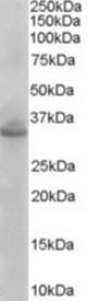Antibody (0.003 ug/ml) staining of Mouse Brain lysate (35 ug protein in RIPA buffer). Primary incubation was 1 hour. Detected by chemiluminescence.