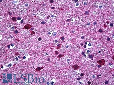 Anti-STXBP1 antibody IHC of human brain, cortex. Immunohistochemistry of formalin-fixed, paraffin-embedded tissue after heat-induced antigen retrieval. Antibody LS-B5576 concentration 10 ug/ml.