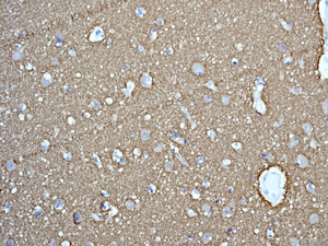 IHC of paraffin-embedded human brain tissue using anti-STXBP1antibody.