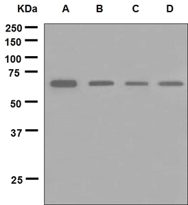 Western blot analysis on (A) SH-SY5Y, (B) HeLa, (C) Jurkat and (D) Y79 cell lysates using anti-STXBP1 antibody.