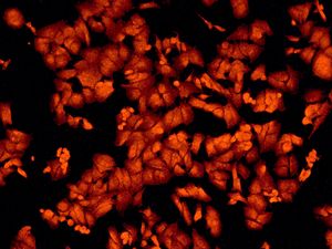 Immunofluorescent staining of SH-SY5Y cells using anti-STXBP1 antibody