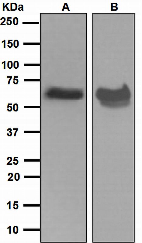 Western blot analysis on (A) SH-SY5Y and (B) fetal brain lysates using anti-STXBP1 antibody.