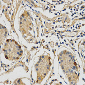 Immunohistochemistry of paraffin-embedded human stomach using STXBP1 antibody at dilution of 1:200 (x400 lens)