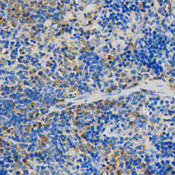 Immunohistochemistry of paraffin-embedded rat spleen using STXBP1 antibody at dilution of 1:200 (x400 lens).
