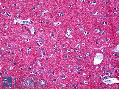 Anti-STXBP1 antibody IHC of human brain, neuropil. Immunohistochemistry of formalin-fixed, paraffin-embedded tissue after heat-induced antigen retrieval. Antibody LS-B5542 concentration 5 ug/ml.