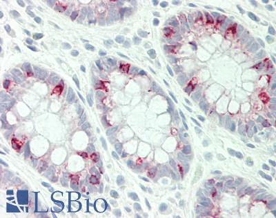 Human Colon: Formalin-Fixed, Paraffin-Embedded (FFPE)