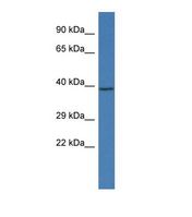 Western blot of Mouse Small Intestine. Styk1 antibody dilution 1.0 ug/ml.