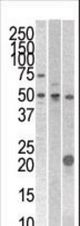 The anti- STYK1 antibody is used in Western blot to detect STYK1 in 293 , CEM , and mouse kidney cell line/tissue lysates.