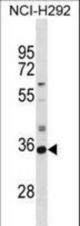 SULT2A1 Antibody western blot of NCI-H292 cell line lysates (35 ug/lane). The SULT2A1 antibody detected the SULT2A1 protein (arrow).