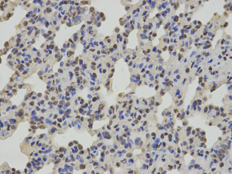 Immunohistochemistry of paraffin-embedded rat lung using SUMO2 antibody at dilution of 1:100 (400x lens).