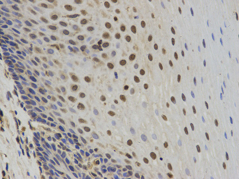 Immunohistochemistry of paraffin-embedded human esophagus using SUMO2 antibody at dilution of 1:100 (200x lens).