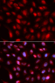 Immunofluorescence analysis of U2OS cell using SUMO2 antibody. Blue: DAPI for nuclear staining.