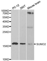 Western blot analysis of extracts of various cell lines, using SUMO2 antibody.