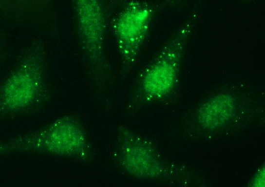 Immunofluorescent staining of HeLa cells using anti-SERPINB3 mouse monoclonal antibody.