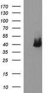HEK293T cells were transfected with the pCMV6-ENTRY control (Left lane) or pCMV6-ENTRY SERPINB3 (Right lane) cDNA for 48 hrs and lysed. Equivalent amounts of cell lysates (5 ug per lane) were separated by SDS-PAGE and immunoblotted with anti-SERPINB3.