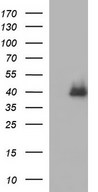 HEK293T cells were transfected with the pCMV6-ENTRY control (Left lane) or pCMV6-ENTRY SERPINB3 (Right lane) cDNA for 48 hrs and lysed. Equivalent amounts of cell lysates (5 ug per lane) were separated by SDS-PAGE and immunoblotted with anti-SERPINB3.