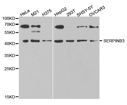 Western blot analysis of extracts of various cell lines, using SERPINB3 antibody.