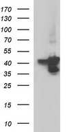 HEK293T cells were transfected with the pCMV6-ENTRY control (Left lane) or pCMV6-ENTRY SERPINB3 (Right lane) cDNA for 48 hrs and lysed. Equivalent amounts of cell lysates (5 ug per lane) were separated by SDS-PAGE and immunoblotted with anti-SERPINB3.