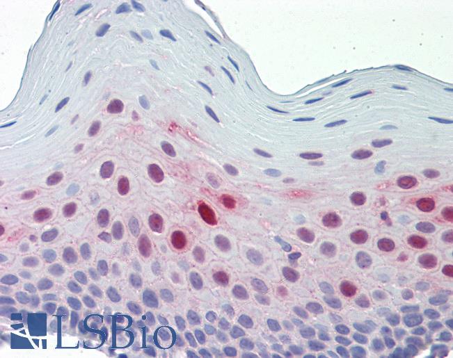 Anti-SERPINB3 / SCCA-1 antibody IHC staining of human tonsil. Immunohistochemistry of formalin-fixed, paraffin-embedded tissue after heat-induced antigen retrieval.