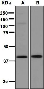 Western blot analysis on (A) A431 and (B) fetal skin lysates using anti-SERPINB3 antibody.