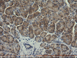 IHC of paraffin-embedded Human pancreas tissue using anti-SERPINB3 mouse monoclonal antibody.