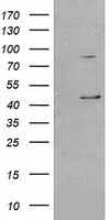 HEK293T cells were transfected with the pCMV6-ENTRY control (Left lane) or pCMV6-ENTRY SERPINB3 (Right lane) cDNA for 48 hrs and lysed. Equivalent amounts of cell lysates (5 ug per lane) were separated by SDS-PAGE and immunoblotted with anti-SERPINB3.