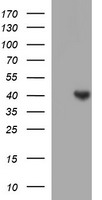 HEK293T cells were transfected with the pCMV6-ENTRY control (Left lane) or pCMV6-ENTRY SERPINB3 (Right lane) cDNA for 48 hrs and lysed. Equivalent amounts of cell lysates (5 ug per lane) were separated by SDS-PAGE and immunoblotted with anti-SERPINB3.