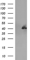 HEK293T cells were transfected with the pCMV6-ENTRY control (Left lane) or pCMV6-ENTRY SERPINB3 (Right lane) cDNA for 48 hrs and lysed. Equivalent amounts of cell lysates (5 ug per lane) were separated by SDS-PAGE and immunoblotted with anti-SERPINB3.