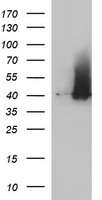 HEK293T cells were transfected with the pCMV6-ENTRY control (Left lane) or pCMV6-ENTRY SERPINB3 (Right lane) cDNA for 48 hrs and lysed. Equivalent amounts of cell lysates (5 ug per lane) were separated by SDS-PAGE and immunoblotted with anti-SERPINB3.