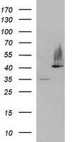 HEK293T cells were transfected with the pCMV6-ENTRY control (Left lane) or pCMV6-ENTRY SERPINB3 (Right lane) cDNA for 48 hrs and lysed. Equivalent amounts of cell lysates (5 ug per lane) were separated by SDS-PAGE and immunoblotted with anti-SERPINB3.