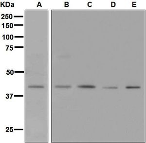 Western blot analysis on (A) Caco-2, (B) human heart, (C) HT-29, (D) K562, and (E) HeLa lysates using anti-TACR2 antibody.