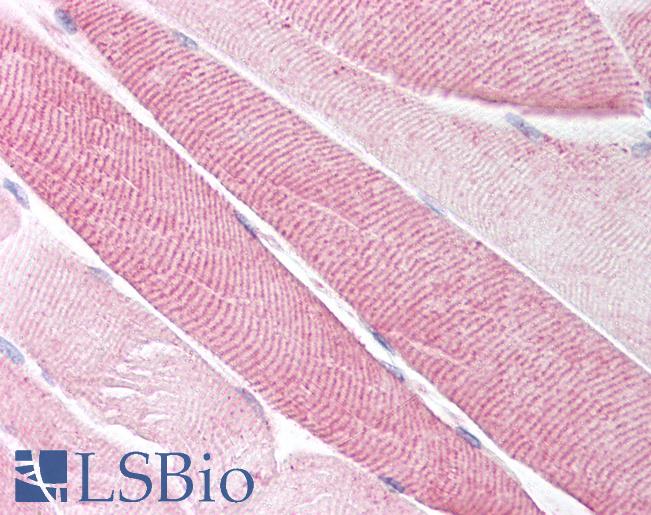 Anti-Neurokinin A Receptor antibody LS-A1290 IHC of human skeletal muscle. Immunohistochemistry of formalin-fixed, paraffin-embedded tissue after heat-induced antigen retrieval.