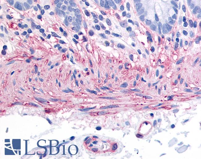 Anti-Neurokinin A Receptor antibody LS-A4320 IHC of human colon, smooth muscle. Immunohistochemistry of formalin-fixed, paraffin-embedded tissue after heat-induced antigen retrieval.