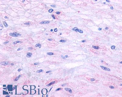 Anti-Neurokinin A Receptor antibody LS-A1287 IHC of human small intestine, muscularis propria. Immunohistochemistry of formalin-fixed, paraffin-embedded tissue after heat-induced antigen retrieval.