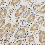 Immunohistochemistry of paraffin-embedded human stomach using PCCB antibody at dilution of 1:200 (x400 lens).