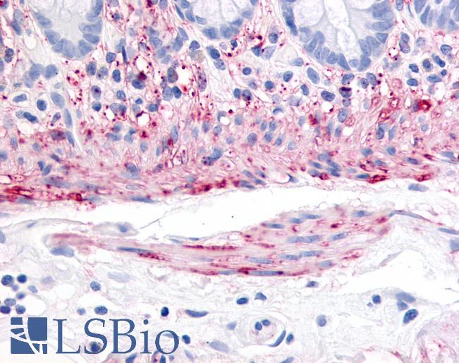Anti-Neurokinin A Receptor antibody LS-A4324 IHC of human colon, smooth muscle. Immunohistochemistry of formalin-fixed, paraffin-embedded tissue after heat-induced antigen retrieval.