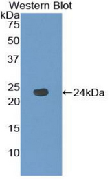 Western blot of recombinant TACR2 / Nk2 / NK2R.