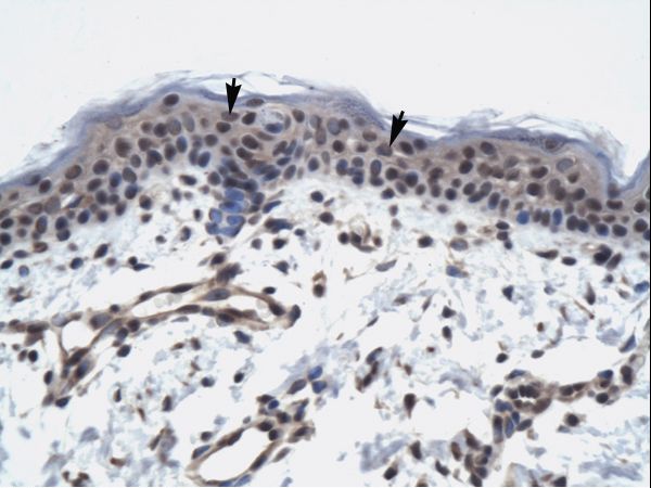 TAF9 antibody LS-C29948 was used in IHC to stain formalin-fixed, paraffin-embedded human skin.