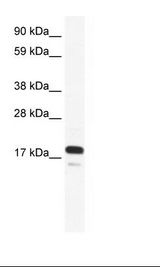 Fetal Small intestine Lysate