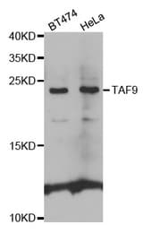 Western blot analysis of extracts of various cell lines, using TAF9 antibody.