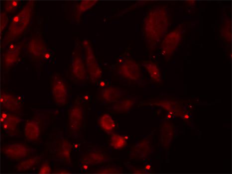 Immunofluorescence analysis of U20S cell using PCCB antibody. Blue: DAPI for nuclear staining.