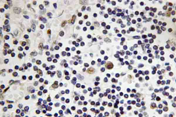 IHC of TAL1 (G116) pAb in paraffin-embedded human lymph node tissue.