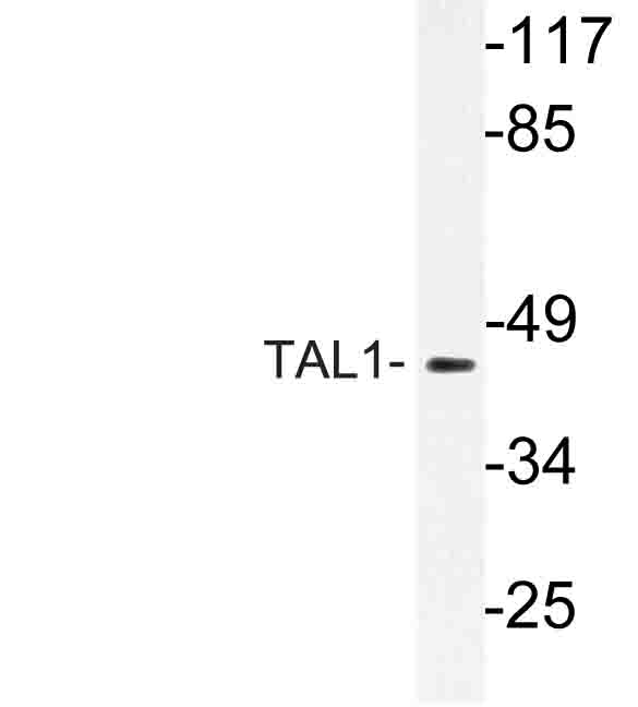 Western blot of TAL1 (G116) pAb in extracts from Jurkat cells.