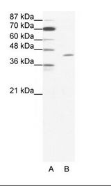A: Marker, B: HepG2 Cell Lysate