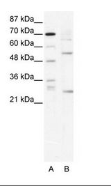 A: Marker, B: HepG2 Cell Lysate