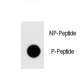 Dot blot of anti-Phospho-TAL1-pT90 antibody on nitrocellulose membrane. 50ng of Phospho-peptide or Non Phospho-peptide per dot were adsorbed. Antibody working concentrations are 0.5ug per ml.