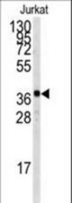 Western blot of anti-TAL1 Antibody (T90) in Jurkat cell line lysates (35 ug/lane). TAL1 (arrow) was detected using the purified antibody.