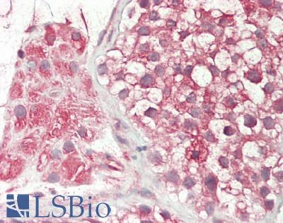 Human Testis: Formalin-Fixed, Paraffin-Embedded (FFPE)