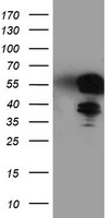 HEK293T cells were transfected with the pCMV6-ENTRY control (Left lane) or pCMV6-ENTRY TAL1 (Right lane) cDNA for 48 hrs and lysed. Equivalent amounts of cell lysates (5 ug per lane) were separated by SDS-PAGE and immunoblotted with anti-TAL1.
